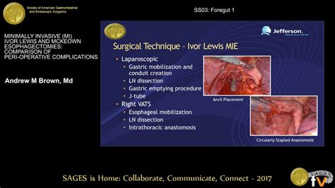 Minimally Invasive Ivor Lewis And Mckeown Esophagectomies Comparison Of