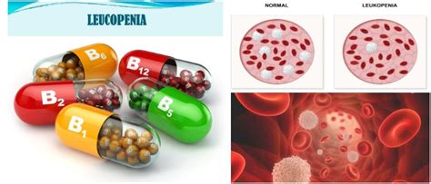 Leucopenia O Leucocitos Bajos Definición Causas Síntomas Diagnóstico Y Tratamiento