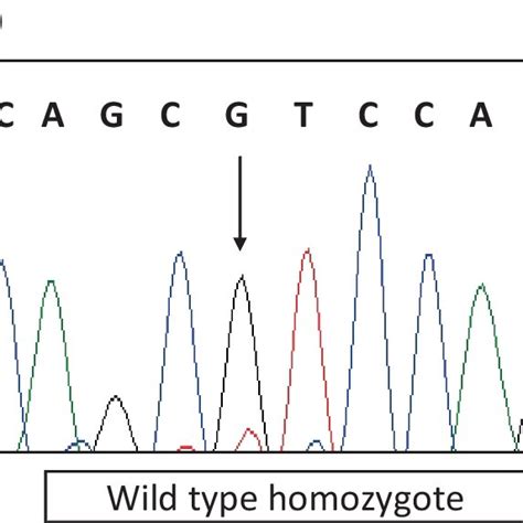 Genotyping Of Single Nucleotide Polymorphisms SNPs Following Sanger