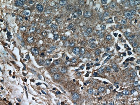 CCT4 Antibody 21524 1 AP Proteintech