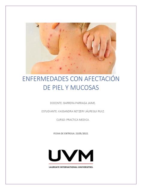 Enfermedades Con Afectación De Piel Y Mucosas Pdf Anemia Sistema