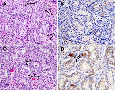 Histopathologic And Immunohistochemical Evaluation Of Biopsied Testis