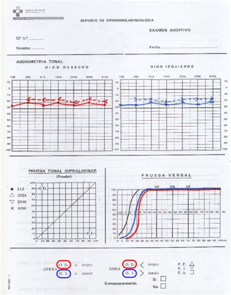 Audiometría Verbal