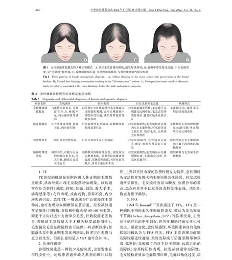 女性雄激素性脱发诊断与治疗中国专家共识（2022版）指南•规范•共识药讯中心湖南药事服务网