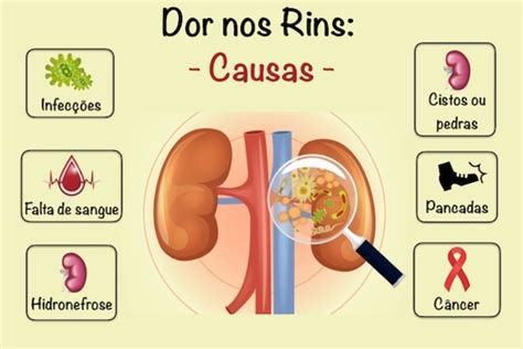 Dor nos Rins ou nas costas Saiba a diferença e comece acabar ela