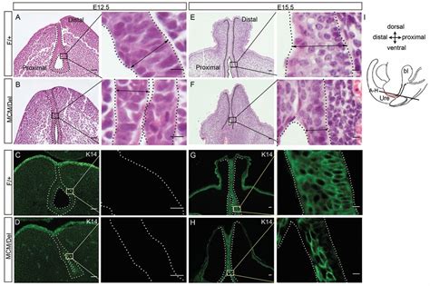 中国农业大学生物学院 科研进展 Cell Death Dis 崔胜课题组发现尿道发育异常新机制