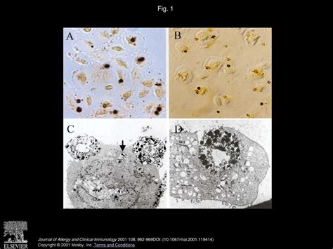 Human Alveolar Epithelial Cells Engulf Apoptotic Eosinophils By Means