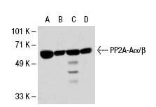 PP2A Aα β抗体 A 5 SCBT Santa Cruz Biotechnology