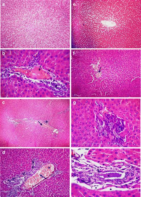 Photomicrograph Of HE Stained Liver Sections A Of Rats Of Control