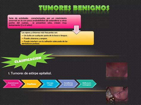 Tumores Benignos De Los Maxilares Patolocos Ppt Descarga Gratuita