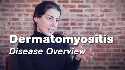 Polymyositis Overview Johns Hopkins Rheumtv