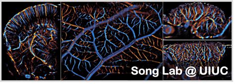 Super Resolution Ultrasound Imaging Songlab Uiuc