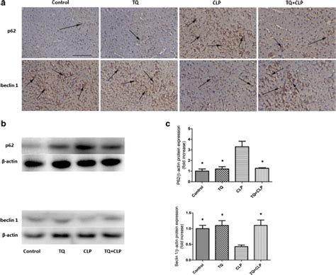 P62 And Beclin 1 Expression In The Cardiac Tissues From The Balbc Mice