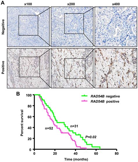 Inhibition Of Rad B Suppresses Proliferation And Promotes Apoptosis In