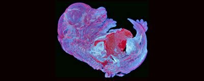 Image of the Day: A Mouse Brain Slice Becomes Art | The Scientist Magazine®