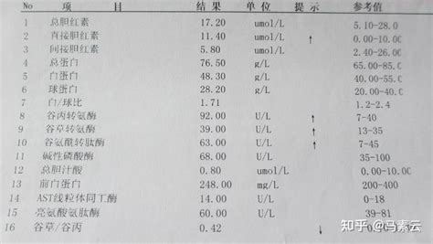 肝功能检查单看不懂不用担心我来教你看懂 知乎