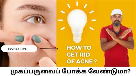 How To Get Rid Of Acne Home Remedies For Acne Natural Tips And