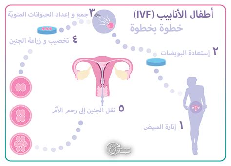 أطفال الأنابيب في ايران عملية طفل الأنبوب بافضل تكلفة و نتائج حياة