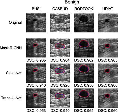 Busset A Benchmark For Quantitative Evaluation Of Breast Ultrasound