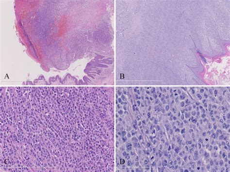 Photomicrographs Of The Cutaneous Lesions A Under Low Power