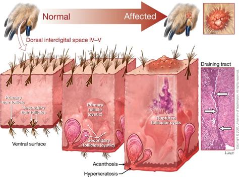 Pathogenesis Of Canine Interdigital Palmar And Plantar Comedones And