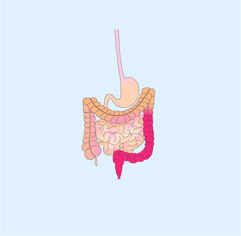 Mistakes In Acute Severe Ulcerative Colitis And How To Avoid Them Ueg United European