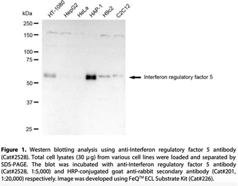 Anti Interferon Regulatory Factor 5 Rabbit Monoclonal Ab 2528 GenuIN