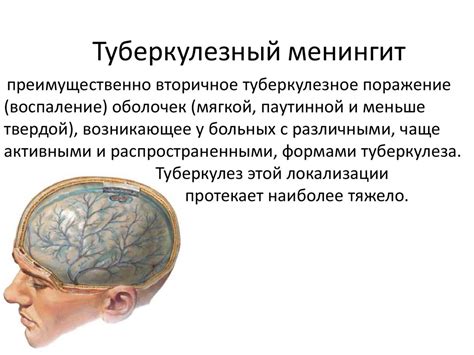 Туберкулез нервной системы - презентация онлайн
