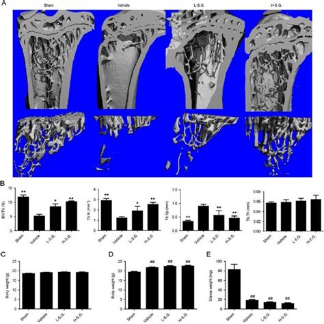 Sanguinarine Prevents Ovariectomyinduced Bone Loss In Vivo A Fixed