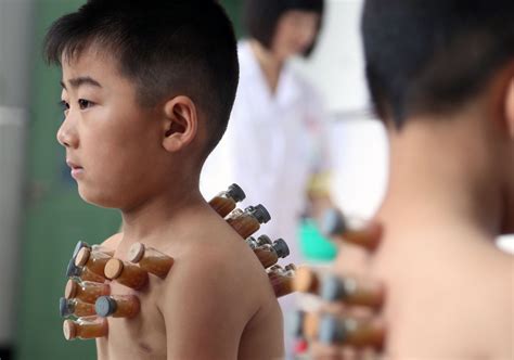 Different Practices Of Traditional Chinese Medicine Tcm Xinhua English News Cn