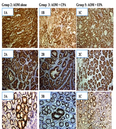 Immunohistochemical Staining Of β Catenin And Cox 2 And Ki 67 In Aom Download Scientific