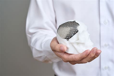 Brain Surgery Revolution Meticuly And Nhso Partner On 3d Printed