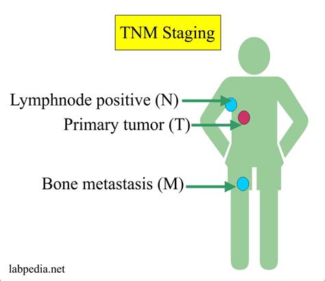 Tumor Marker Part 1 Definition Of Tumor Markers Staging And