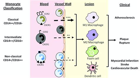 Monocyte Mayhem Circulation Cardiovascular Genetics