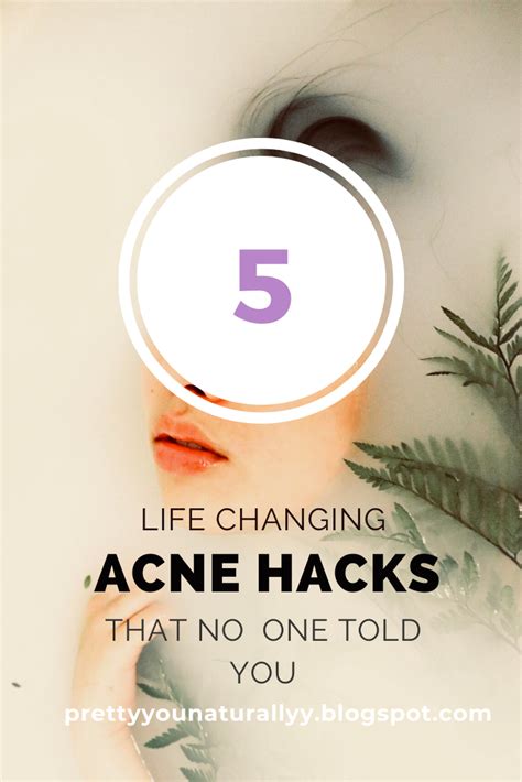 5 Effective Acne Clearing Tips That No One Told You