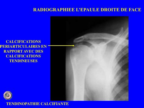 PDF cours de radiologie pdf PDF Télécharger Download