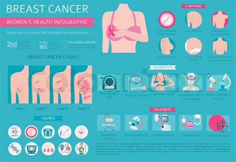 Breast Cancer Medical Infographic Diagnostics Symptoms Treatment