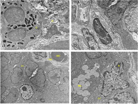 Electron Micrographs Showing Representative Sections Of Rat Duodenal