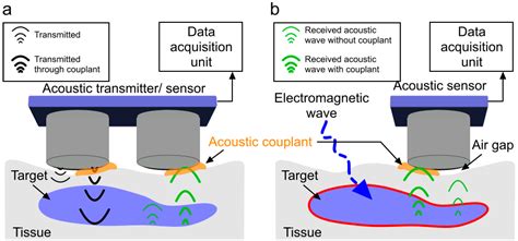 Acoustic Gel Ultrasound at Chris Stevens blog