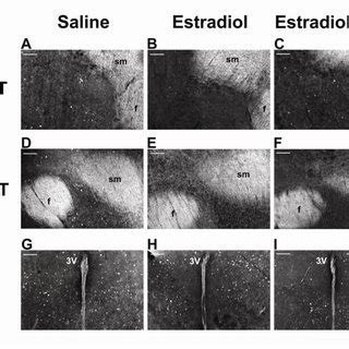 Photomicrographs From Short Day Mice Of C Fos Immunoreactivity In The