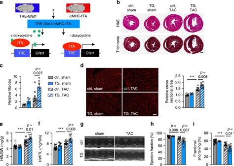 Cardiac Specific Overexpression Of Gfat Leads To A More Profound