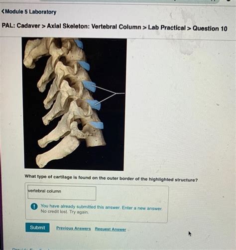 Solved Axial Skeleton Skull Lab Practical Question Chegg