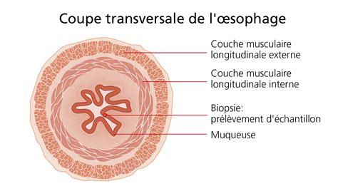 Diagnostiquer La Dysphagie Troubles De La D Glutition