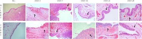 Changes Of Regenerated Epithelium On The Wound Surface Of The Three