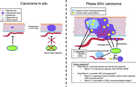 Schematic Of The Regulation Of Tumor Growth Angiogenesis And Cancer