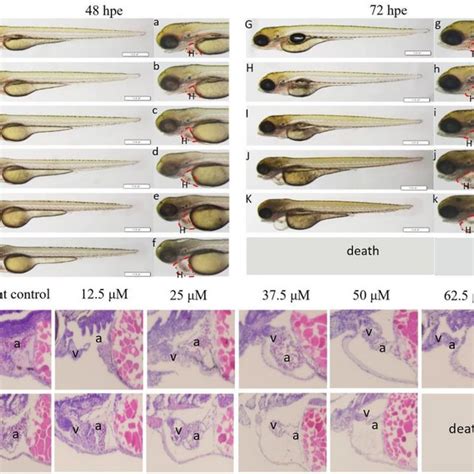 Clozapine Induced Developmental And Cardiac Toxicity On Zebrafish