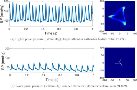 A Novel Method To Quantify Arterial Pulse Waveform Morphology