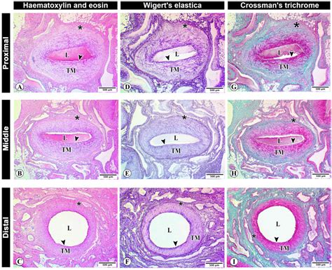 Histological Architecture Of The Testicular Artery Wall Download