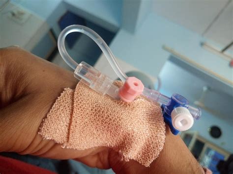 Premium Photo Close Up Of Hand With Iv Drip In Hospital