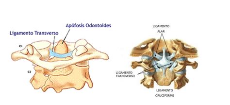 Inestabilidad Atlanto Axial Clínica Reumatológica Dr Ponce